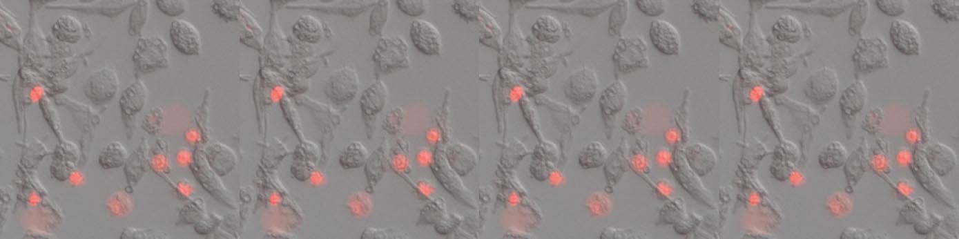 Pyroptosis